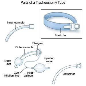 Parts of Tracheostomy Tube 