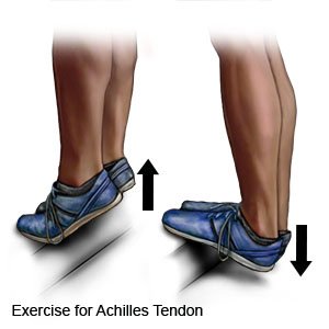 Exercise for Achilles Tendon