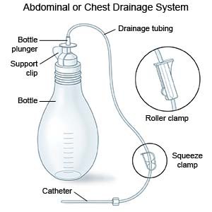 Abdominal or Chest Drainage System