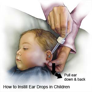 How to Instill Ear Drops in Children