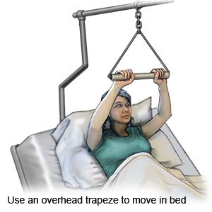 How to Use an Overhead Trapeze