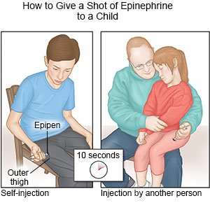 Give a Shot of Epinephrine Child 