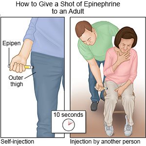 How to Give An Epinephrine Shot Adult