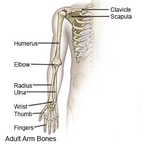 Bone pain clearance in arm