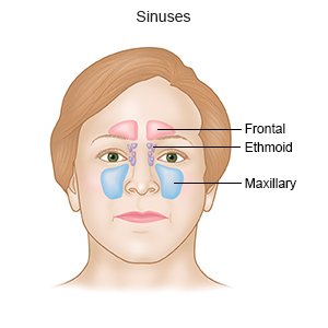 sinus canal infection