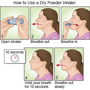 How to Use a Dry-powder Inhaler