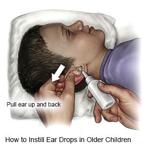 How to Instill Ear Drops in Older Children