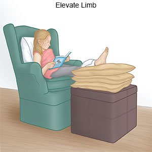 Elevate Leg (Child)