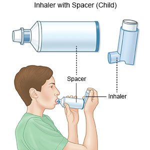 Inhaler with Spacer (Child)