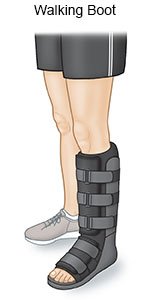 Walking Boot FAQs - What You Need to Know