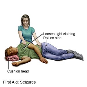 First Aid: Seizures (ADULT)