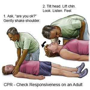 Check Responsiveness on an Adult