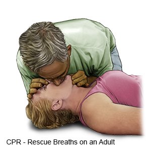Rescue Breaths on an Adult