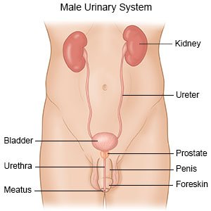 Signs that Your UTI Might be Getting Worse