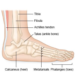 Heel Spur - What You Need to Know