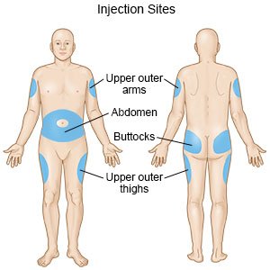 Injection Sites