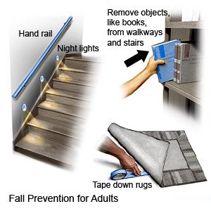 Fall Prevention for Adults