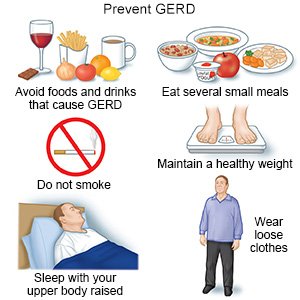 Prevent GERD