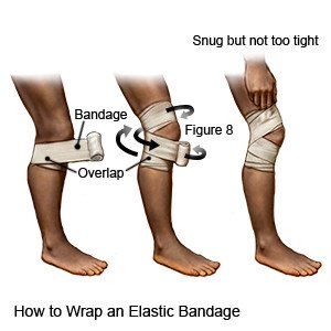 How to Wrap an Elastic Bandage