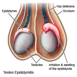 Testes Epididymitis