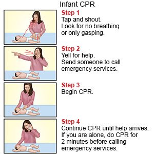 Infant CPR