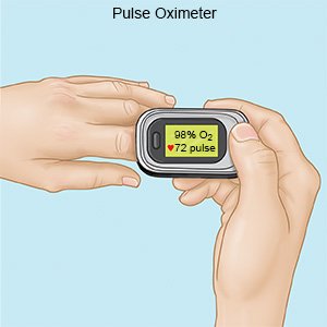 Pulse Oximeter