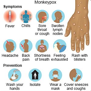 What are the Symptoms of Monkeypox?