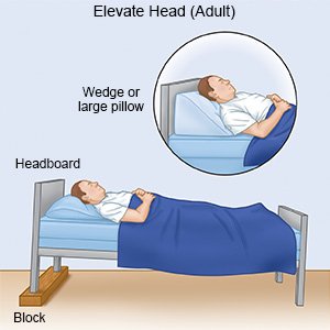 Elevate Head (Adult)