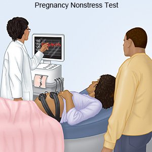Pregnancy Nonstress Test