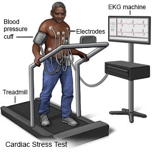 Cardiac Stress Test