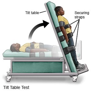 Tilt Table Test