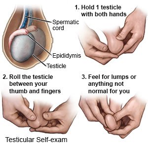 Testicular Self-exam