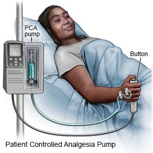 Patient Controlled Analgesia Pump