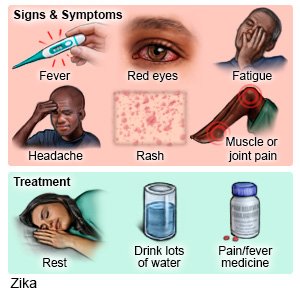 Zika Signs, Symptoms, and Treatment