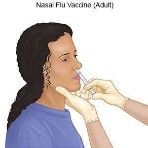 Nasal Flu Vaccine (Adult)