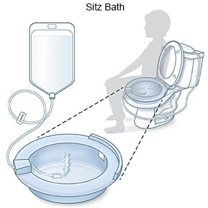 Sitz Bath