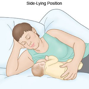Side-Lying Position