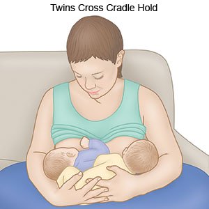 Twins Cross Cradle Hold