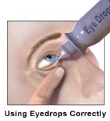 Picture of using eye drops correctly
