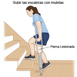 Subir la escalera con muletas THA