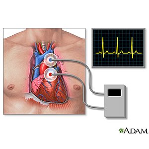 instrucciones sobre process monitor sysinternals
