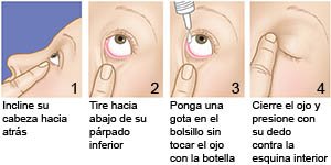 Cómo ponerse Gotas en los Ojos?