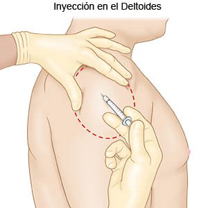 Where to inject steroids in glute diagram