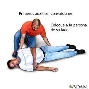 Primeros auxilios: Convulsiones