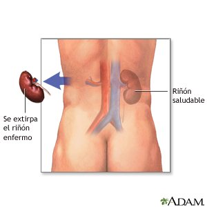 Duele los riñones cuando estás da en el pie