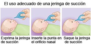 Cómo Usar Una Jeringa De Succión Care Guide Information En Espanol