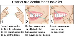 Usar hilo dental todos los días