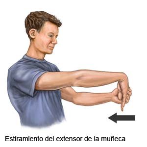 Elongación del extensor de la muñeca