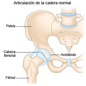 Qué es el pinzamiento femoroacetabular: síntomas y ejercicios