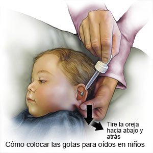 Cómo colocar las gotas para oídos en niños